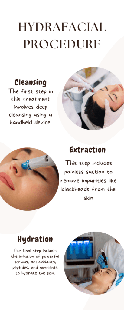 https://media.olivaclinic.com/website-media/2024/04/Hydrafacial-Treatment.png