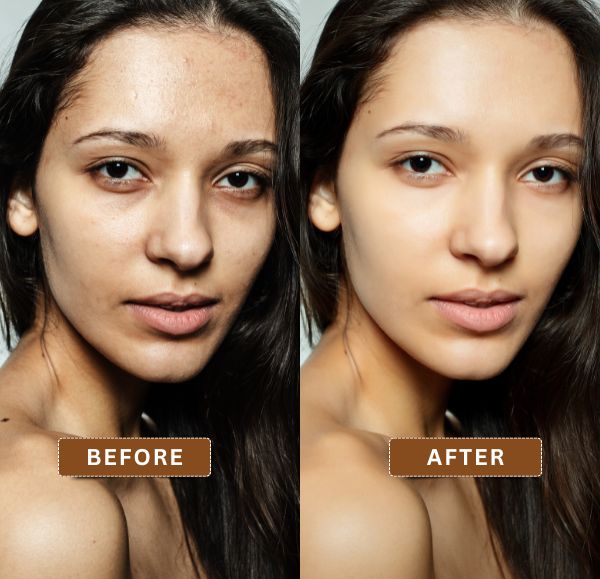 BB Glow Before and After Skin Tone Improvement with BB Glow Facial