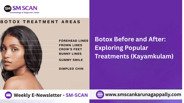 Botox Before and After: Exploring Popular Treatments (Kayamkulam)